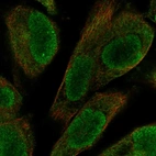 Anti-UACA Antibody