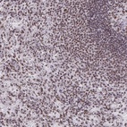 Anti-SNRNP70 Antibody