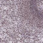 Anti-SNRNP70 Antibody