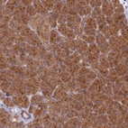 Anti-HOOK2 Antibody