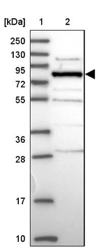 Lane 1: Marker [kDa] 250, 130, 95, 72, 55, 36, 28, 17, 10_br/_Lane 2: Human cell line RT-4