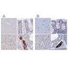Anti-CYP51A1 Antibody
