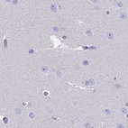 Anti-CYP51A1 Antibody