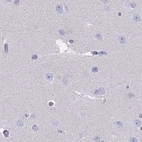 Immunohistochemical staining of human cerebral cortex using Anti-CYP51A1 antibody HPA043508.
