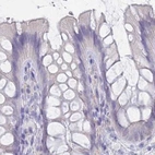 Immunohistochemical staining of human colon using Anti-CYP51A1 antibody HPA043508.