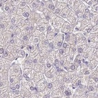 Anti-CYP51A1 Antibody