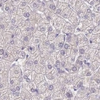 Immunohistochemical staining of human liver using Anti-CYP51A1 antibody HPA043508.