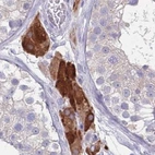 Immunohistochemical staining of human testis using Anti-CYP51A1 antibody HPA043508.