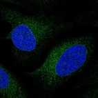 Immunofluorescent staining of human cell line U-2 OS shows localization to endoplasmic reticulum.