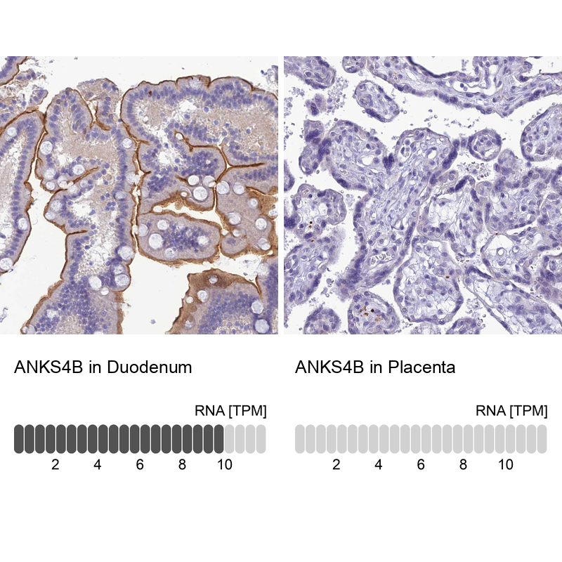 Anti-ANKS4B Antibody