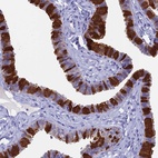 Immunohistochemical staining of human fallopian tube shows high expression.