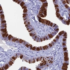 Immunohistochemical staining of human fallopian tube shows high expression.