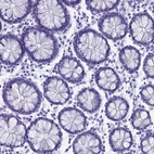 Immunohistochemical staining of human colon shows low expression as expected.