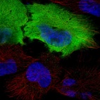 Immunofluorescent staining of human cell line U-251 MG shows localization to nucleoplasm, plasma membrane & cytosol.
