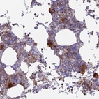 Anti-STRN4 Antibody