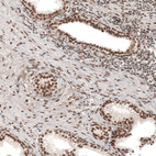 Immunohistochemical staining of human prostate shows moderate to strong nuclear positivity in glandular cells.