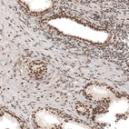 Immunohistochemical staining of human prostate shows moderate to strong nuclear positivity in glandular cells.