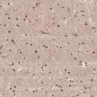 Immunohistochemical staining of human cerebral cortex shows moderate to strong nuclear positivity in neurons.