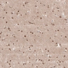 Immunohistochemical staining of human cerebral cortex shows moderate to strong nuclear positivity in neurons.