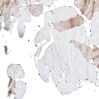 Immunohistochemical staining of human skeletal muscle shows very weak positivity in myocytes.