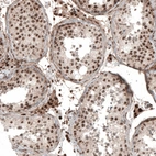 Immunohistochemical staining of human testis shows moderate to strong nuclear positivity in Leydig cells and cells in seminiferous ducts.