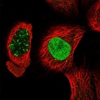 Immunofluorescent staining of human cell line A-431 shows localization to nucleus & nuclear bodies.