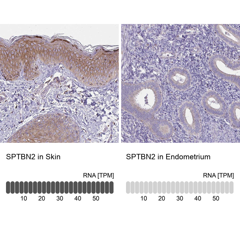 Anti-SPTBN2 Antibody