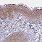 Immunohistochemical staining of human skin shows high expression.