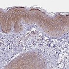Immunohistochemical staining of human skin shows high expression.