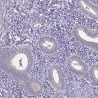Immunohistochemical staining of human endometrium shows low expression as expected.