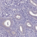 Immunohistochemical staining of human endometrium shows low expression as expected.