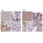 Anti-DUS2 Antibody