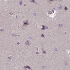 Immunohistochemical staining of human cerebral cortex using Anti-DUS2 antibody HPA043528.