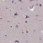 Immunohistochemical staining of human cerebral cortex using Anti-DUS2 antibody HPA043528.