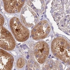 Immunohistochemical staining of human kidney using Anti-DUS2 antibody HPA043528.