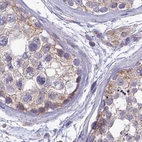 Immunohistochemical staining of human testis using Anti-DUS2 antibody HPA043528.