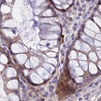 Immunohistochemical staining of human colon using Anti-DUS2 antibody HPA043528.
