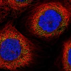 Immunofluorescent staining of human cell line A-431 shows localization to cytosol.