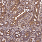 Immunohistochemical staining of human duodenum shows strong cytoplasmic positivity in glandular cells.