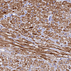 Immunohistochemical staining of human heart muscle shows strong cytoplasmic positivity in cardiomyocytes.