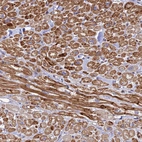 Immunohistochemical staining of human heart muscle shows strong cytoplasmic positivity in cardiomyocytes.