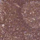 Anti-PPP1R12C Antibody