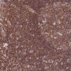Immunohistochemical staining of human lymphoid node shows strong cytoplasmic and membranous positivity in germinal and non germinal center cells.