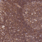 Immunohistochemical staining of human lymphoid node shows strong cytoplasmic and membranous positivity in germinal and non germinal center cells.