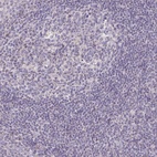 Immunohistochemical staining of human tonsil shows low expression as expected.