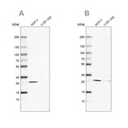 Western blot analysis using Anti-FAHD1 antibody HPA043534 (A) shows similar pattern to independent antibody HPA043226 (B).