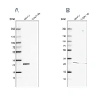 Western blot analysis using Anti-FAHD1 antibody HPA043534 (A) shows similar pattern to independent antibody HPA043226 (B).