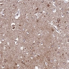 Anti-EVA1B Antibody