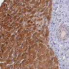 Anti-FZR1 Antibody
