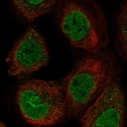 Immunofluorescent staining of human cell line A-431 shows localization to nucleoplasm & nuclear membrane.